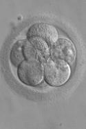 SpermSample.JPG