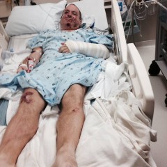 Marcus Mathews laid up in 2014