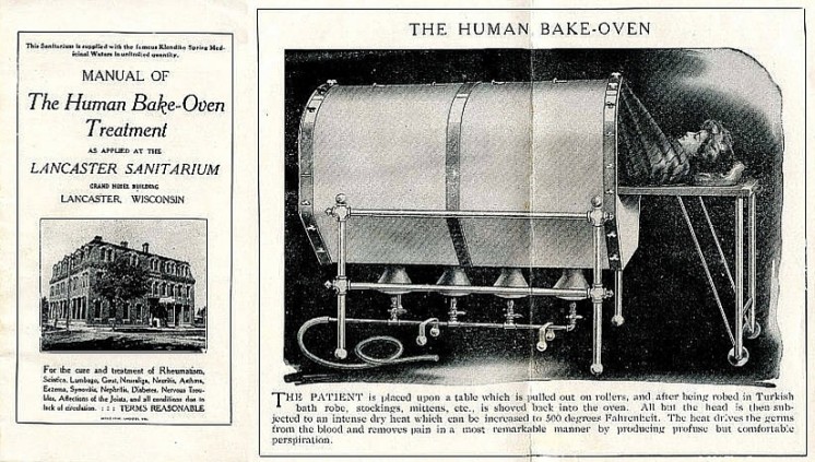 The Human Bake-Oven